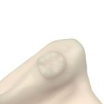 Beige Orthodontic Opposite Jaw Model Resin