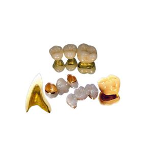 Quality Color Stable PFM Full Crown High Strength Beautiful Appearance wholesale
