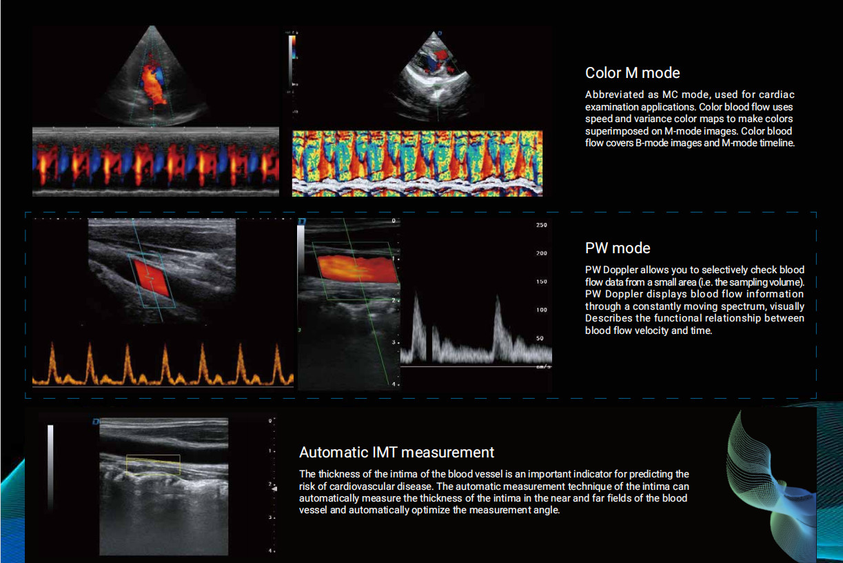 3D 4D 5D Vascular Medical Ultrasound Instruments Portable Color Doppler Ultrasound