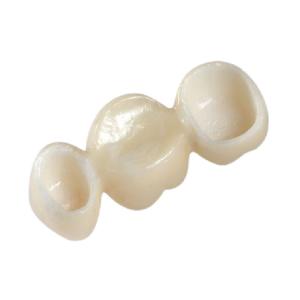 Quality Beautiful Natural All Ceramic Crown Zirconia Material Good Biocompatibility wholesale