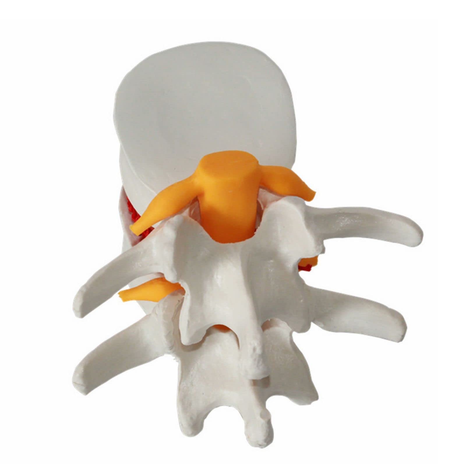 3D Vertebrae Cervical Spine Model 1.5X Lumbar Vertebral Spine Herniation
