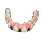 Precision Digital 3D Printing Dental Implant Bar Metal Based