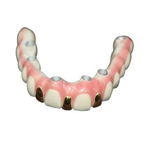 Quality Precision Digital 3D Printing Dental Implant Bar Metal Based wholesale