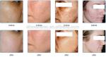Photobiology PDT LED Light Therapy Machine Skin Rejuvenation High Efficiency