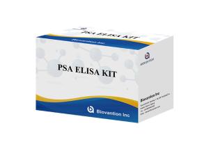 Quality High Accuracy Total PSA Prostate-Specific Antigen Elisa Test Kit wholesale