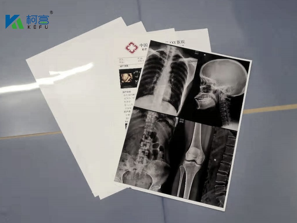 Glossy Medical X Ray Films With 210 Microns Blue Film Thickness