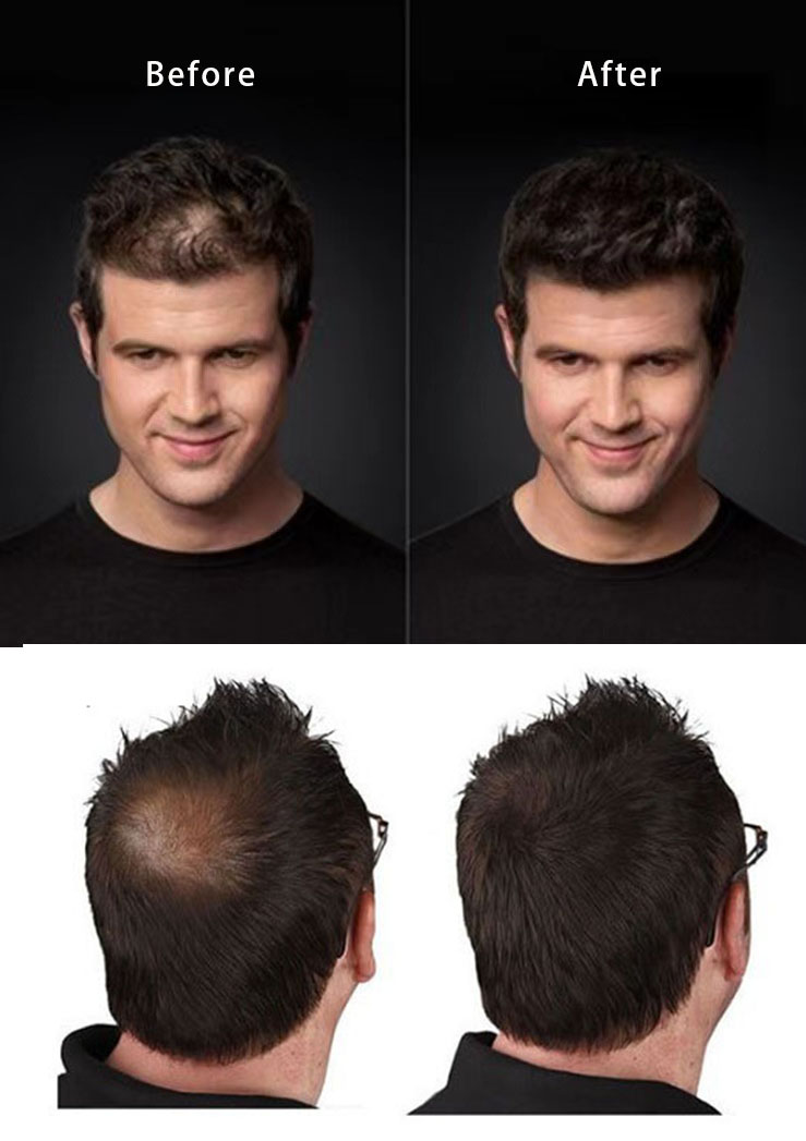 Effective Hair Building Fiber Powder Spray Applicator for Thick and Revitalized Hair