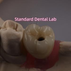 Quality Screw Retained Dental Implant Crown PFZ Porcelain Layered Zirconia wholesale