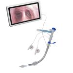 Camera 35fr 37fr 39fr Endobronchial Blocker In Emergency Department