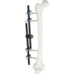 Excellent Quality Orthopedic Surgical Instruments External Fixator Instrument