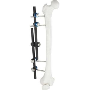 Quality Hot Sale Orthopedic Surgical Instruments Tibial &amp; Femur External Fixator AO External Fixation Orthopedic Instrument wholesale