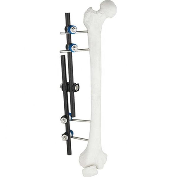 Hot Sale Orthopedic Surgical Instruments Tibial & Femur External Fixator AO