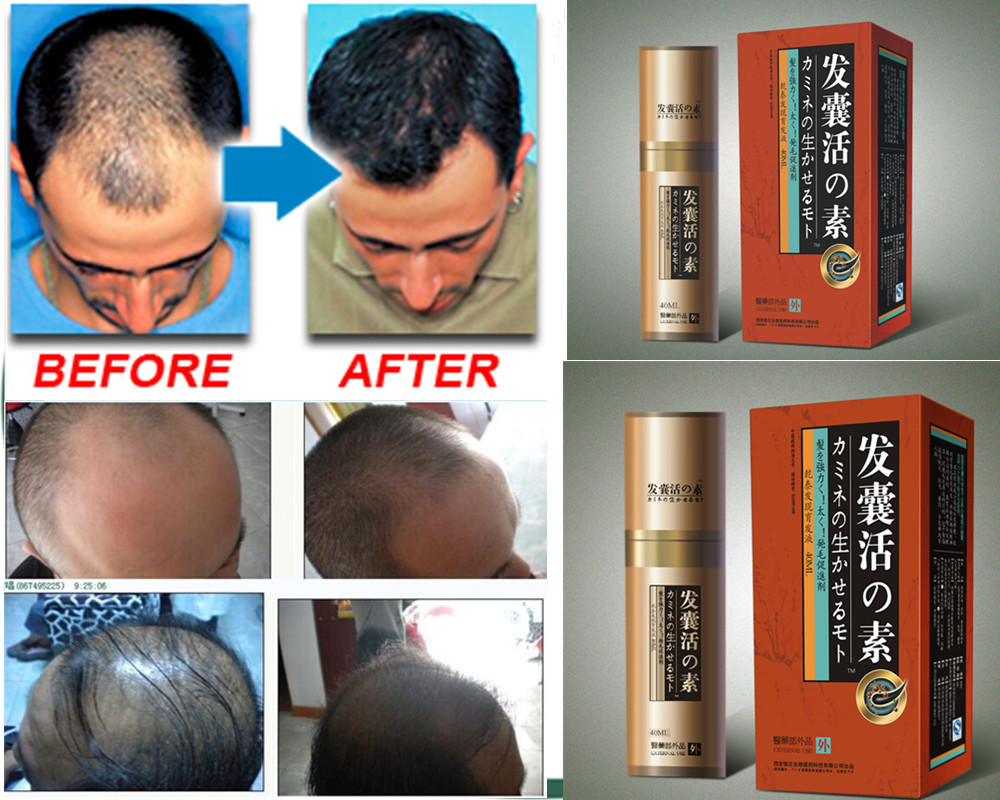 hair treatment Hair Growth Essence anti hair Loss Liquid dense unix hair conditioner Serum