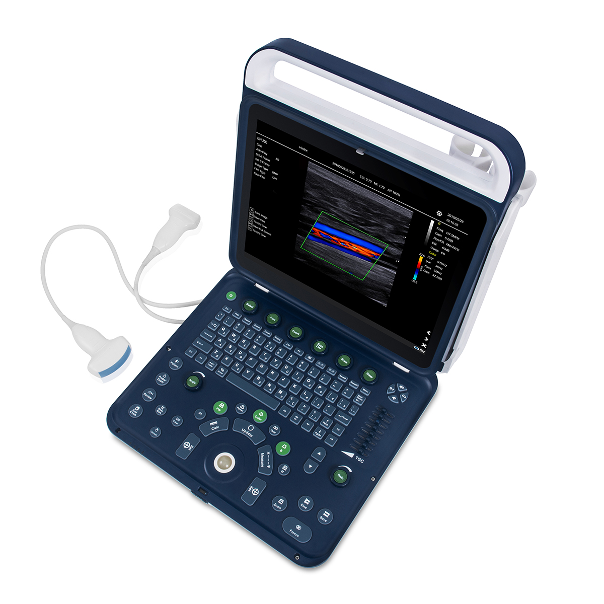 Color Doppler Portable Ultrasound Machine Medical USG PW CW DICOM Cardiac Probe Cardiology for Hospital Clinic