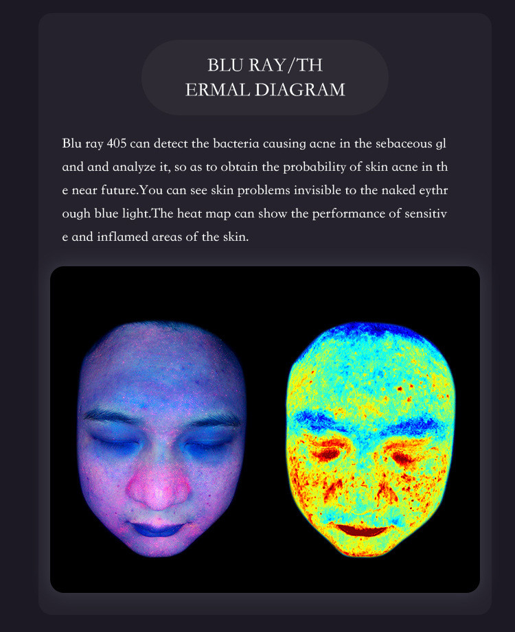 AI Facial Skin Scanner Analyzer 50Hz-60Hz Skin Analysis Equipment For Home / Spa