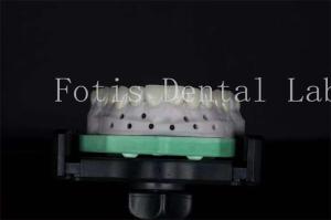 Quality High Strength Dental Lab Veneers Customizable For Natural Smiles wholesale