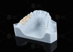 Translucency White Full Contour Zirconia Crown FCZ Monolithic Zirconia Crown