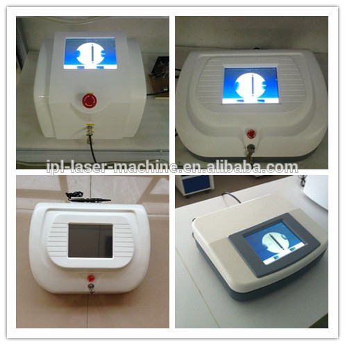 spider vein removal machine.jpg