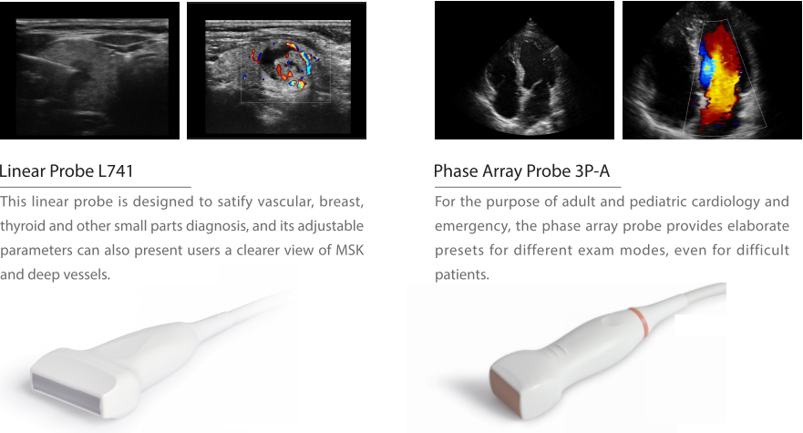 CE approved Sonoscape ultrasound machine Sonoscape X3