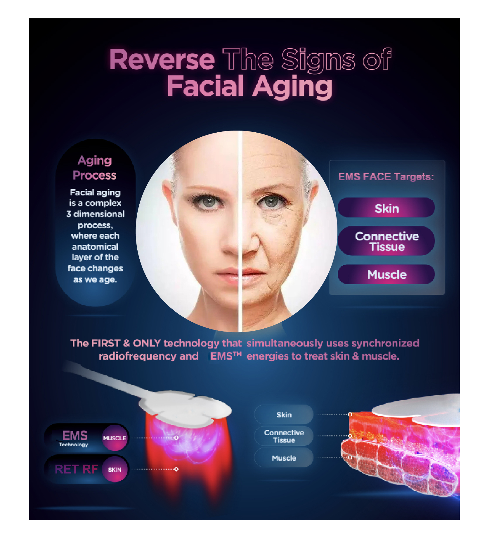 AU Plugs Type Microcurrent Facial Machine for Skin Tightening and Wrinkle Reduction