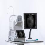 4mm Non Mydriatic Retinal Camera FFA Cataract Disease Imaging