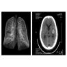 Buy cheap Blue PET Medical X Ray Film 14 x 17in Agfa Drystar 5503 For Hosipital from wholesalers