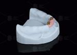Titanium Locator Dental Attachments For Overdentures In Silver And Gold Finish