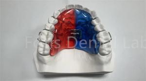 Quality Individual Orthodontic Expander For Dental Correction And Improvement wholesale