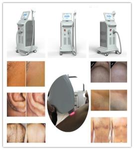 Quality Professional triple wave length laser hair removal 755/808/1064nm diode laser hair removal machine wholesale
