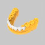 3D Printed Bleach Temporary Veneer Resin for Dental Restorations