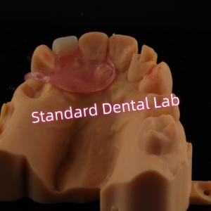 Quality Upper Valplast Unilateral Dentures Removable Flexible One Tooth Partial Teeth wholesale