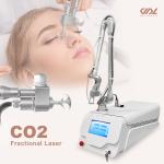 V11 Portable Co2 Fractional Laser 60W Co2 Fraccionado Laser Vaginal Tightening