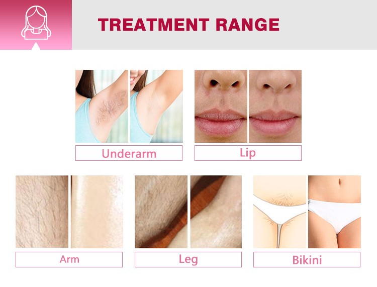 755 808 1064nm diode laser/diodenlaser 808nm handstuck/ Portable 808nm diode laser hair removal machine price for sale