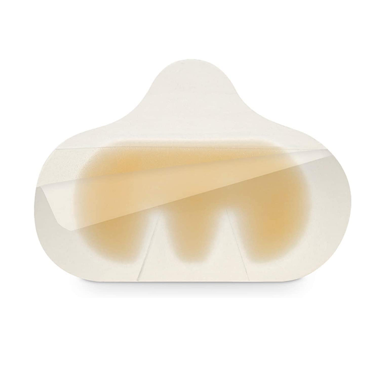 Self Adhesive hydrocolloid wound dressing for Foot Healing