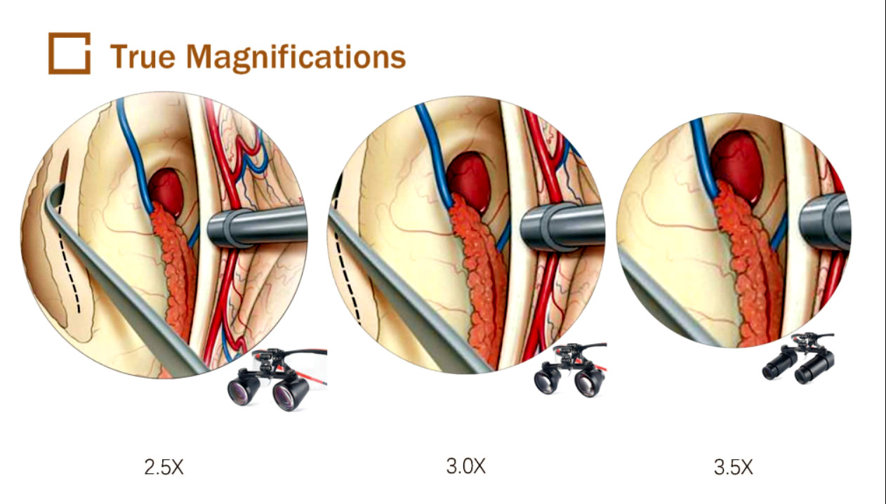 Ergonomic Dental Binocular Loupes Surgical Eye Loupes Adjustable