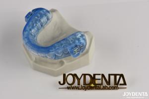 Quality Transparent Dental Snoring Device Mouth Guards Snore Relief Teeth Guard Comfortable wholesale