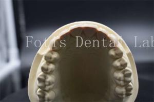 Quality High Strength Artificial Teeth Veneers Dentist Porcelain Veneers Natural Looking wholesale