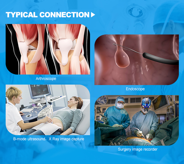 Ultrasound Medical Video Recorder with Electric Power Source for Record Streaming