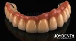 Casting And Milling PFM Tooth Crown , Dental Restorations Porcelain Fused Metal