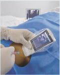 Medical Wifi Ultrasound Machine Android Portable Wireless Ultrasound Probe