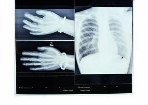 Quality Konida Medical X Ray Dry Film Thermal For AGFA 5300 / Fuji 3000 wholesale