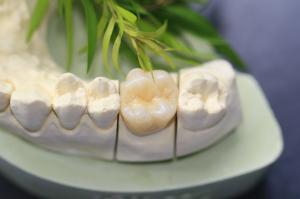 Quality Design Dental Lab Monolithic Zirconia Dental Crown For Molars Posterior Teeth wholesale