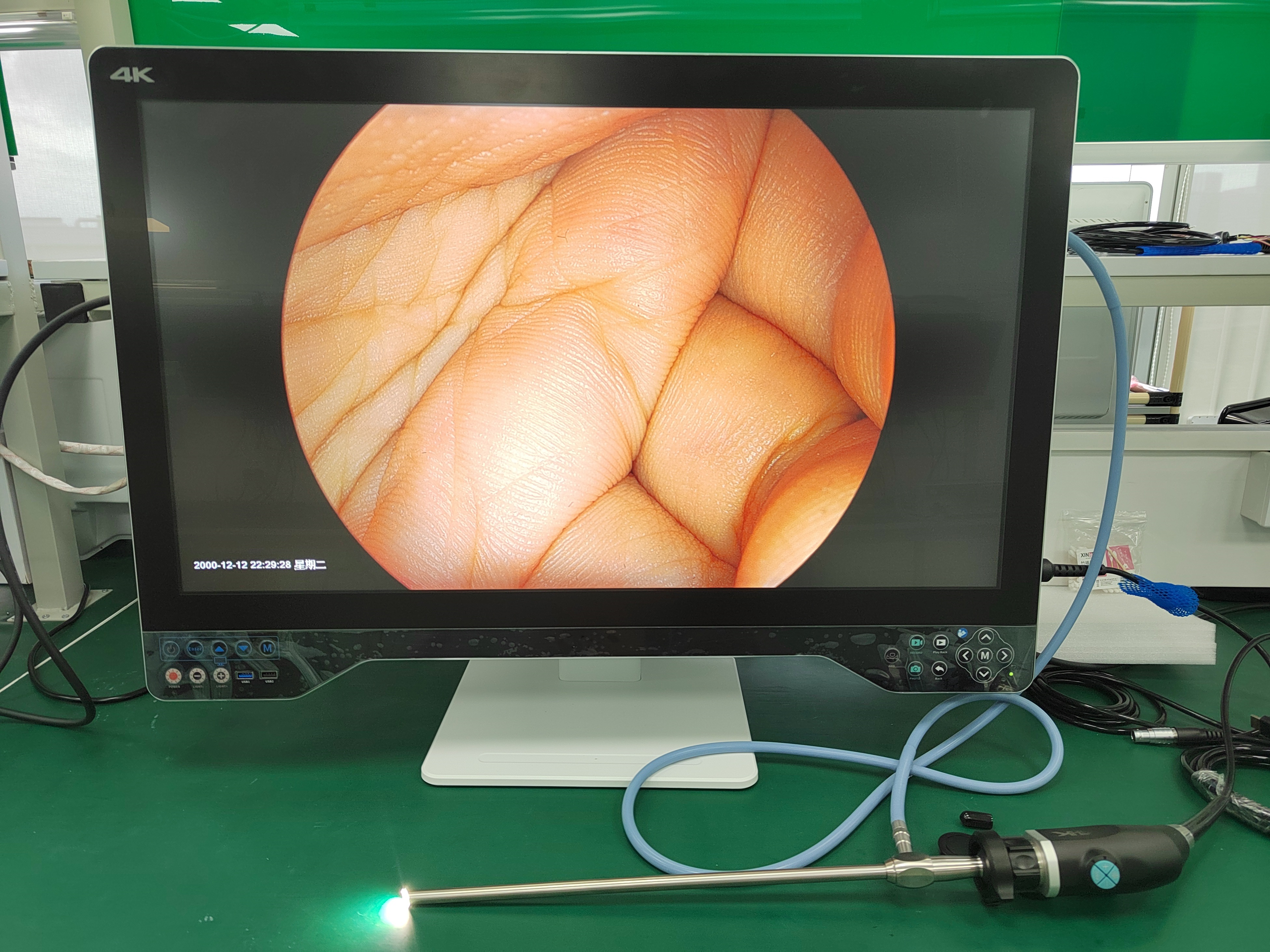 Precision 32" 4K Medical ENT Endoscope Camera USB Laparoscopic System Complete With Light Source And Monitor