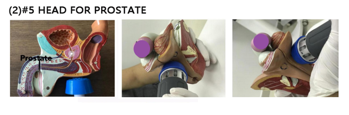 Noninvasive Mini Shockwave Therapy Devices For ED Therapy Machine 350W shockwave therapy for back pain