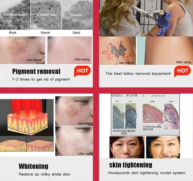 7 Joints Laser Skin Rejuvenation Machine 500-800ps Nd Yag