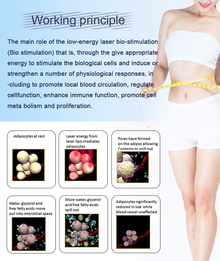 Commercial Portable Weight Loss Lipo Laser Therapy Machine 336 Diode Wavelength