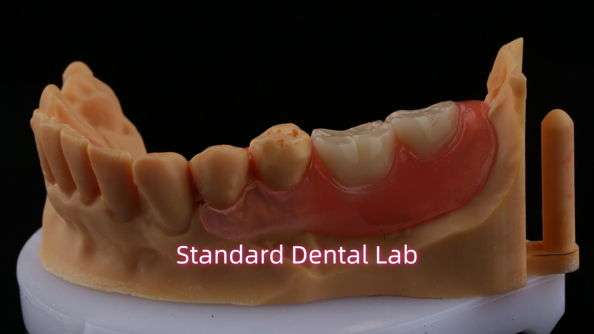 Ace Teeth Pink/Dark TCS Valplast Flexible Partial Dentures for High Esthetics Dental 3D Print Model