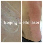 Professional IPL SHR Hair Removal Machine Multi Functional Skin Care Beauty