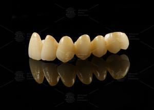 Quality Strong Aesthetic Porcelain Fused To Zirconia For Natural Looking Restorations wholesale