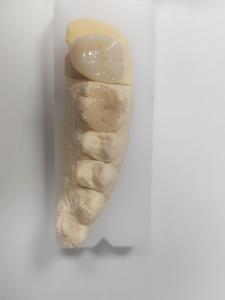 Quality Dental Inlay And Onlay For Indirect Filling And Tooth-Colored Restoration wholesale